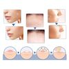 Патчи стикеры от прыщей Skin Tag Patches 144 шт оптом